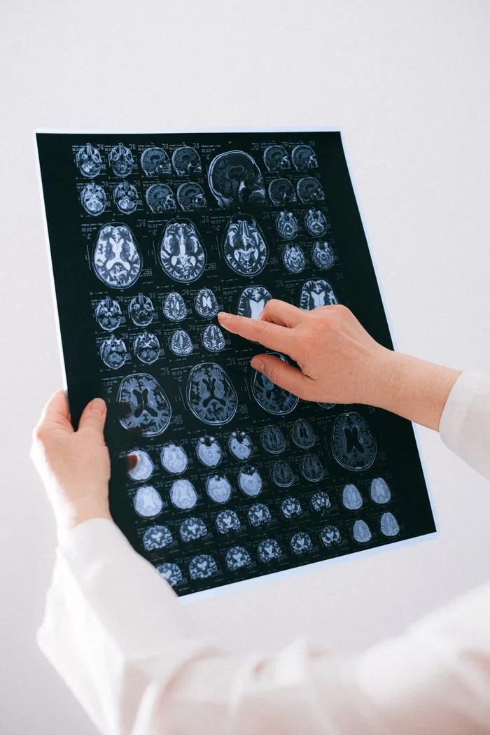 Médico señalando con el dedo imágenes de resonancia cerebral