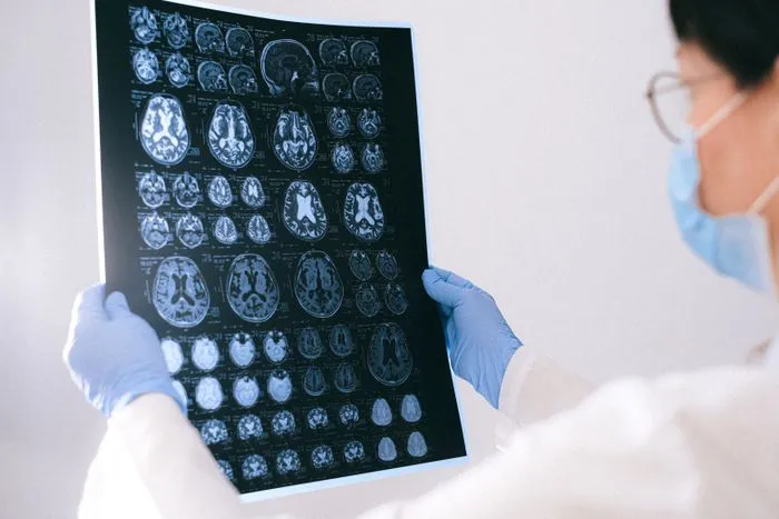 Neuróloga con guantes revisando imágenes de resonancia cerebral
